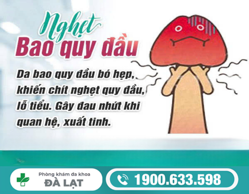 Hình ảnh minh họa